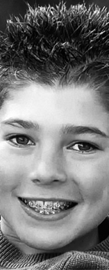 Perfect Smile Orthodontic smile